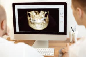 dentists looking at digital x-ray