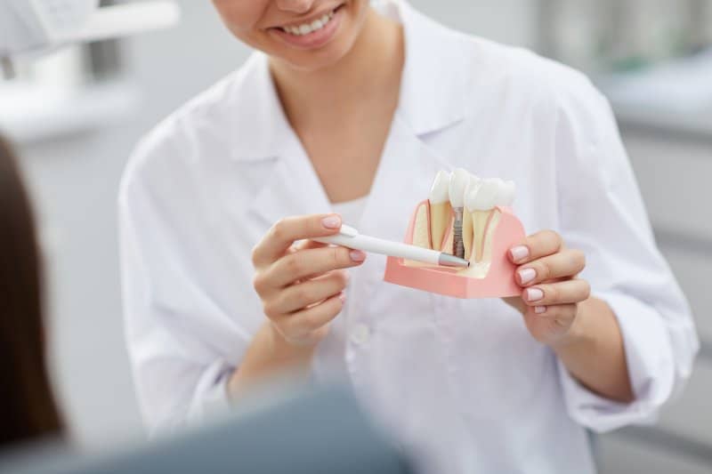 dentist explaining how dental implants work