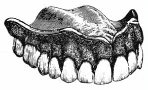 drawing of historical dentures 