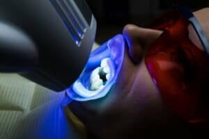 a person getting their teeth professionally whitened with a cosmetic dentist